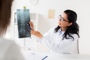 Doctor holding up x-ray and showing to patient